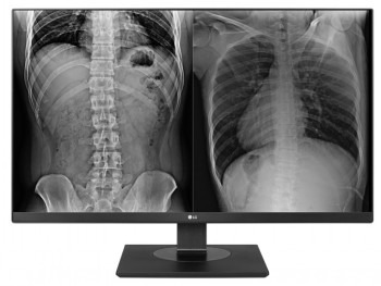 LG 27HJ713C 27" CLINICAL UHD IPS DVI/DP/HDMI