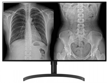 LG DIAGNOSTIC MONITOR, 31.5", 8MP, 450CD/M2, DCI-P3 98%, HAS/PIVOT